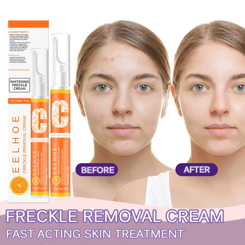 EELHOE-Whitening-Freckle-Cream-Remove-Dark-Spots-Melanin-Melasma-Remover-Brighten-Skin-Anti-Aging-Skin-Lightening.jpg_Q90.jpg_ (1)