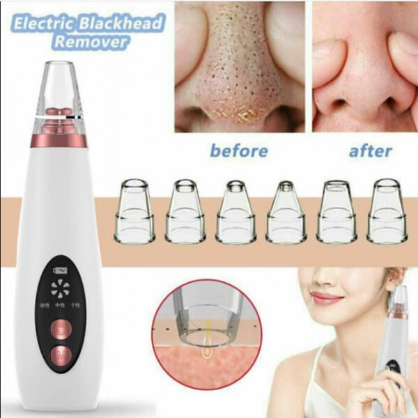 blackhead2